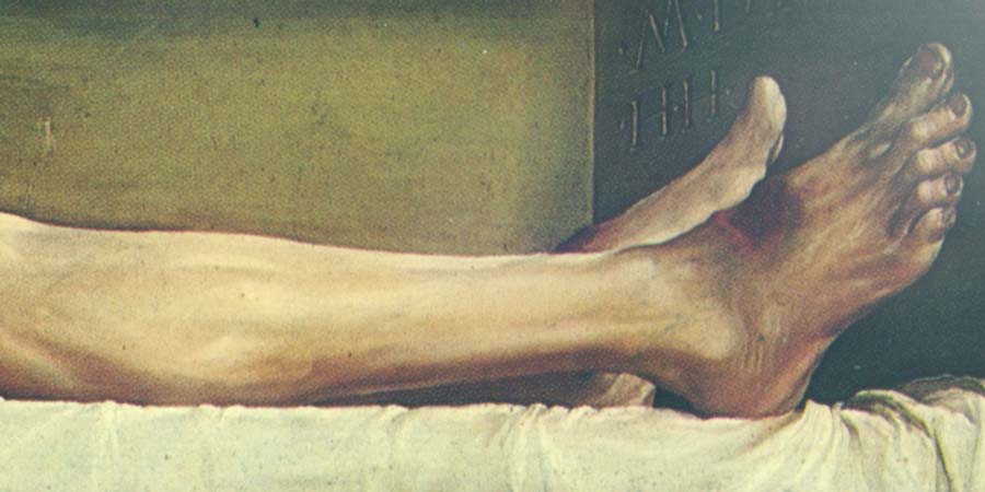 Dead Christ